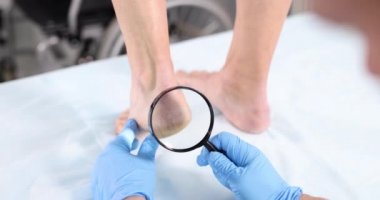 Dermatolog, büyüteçle bacakların derisini muayene ediyor.