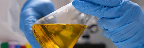 Científico químico en guantes de goma protectora sosteniendo matraz con primer plano líquido amarillo — Foto de Stock
