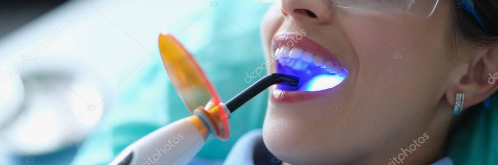 Dentist using dental ultraviolet curing light tool during procedure with patient in clinic
