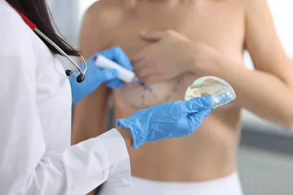 Läkare rita preoperativ märkning på patientens bröst och hålla implantat närbild — Stockfoto