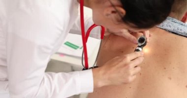 Doktor dermatolog onkolojist hastanın sırtındaki büyüteçle benleri inceliyor.
