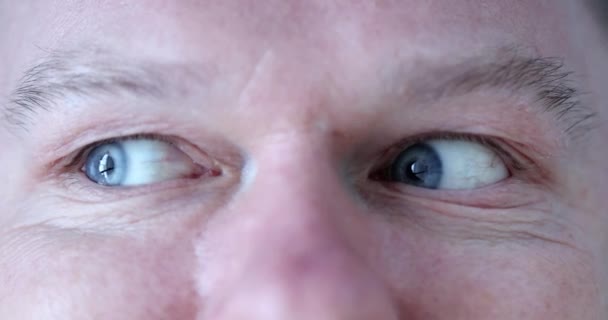 Man with blue eyes does a warm-up for eyes — Stock Video