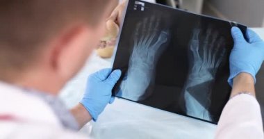 Doktor travmatolog, arka plandaki ayakların röntgenine bakıyor. Ağrıyan bacak 4K film slow motio.