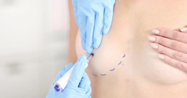 Plastisch chirurg tekening lijn van borst patiënt met marker closeup 4k film slow motion — Stockvideo