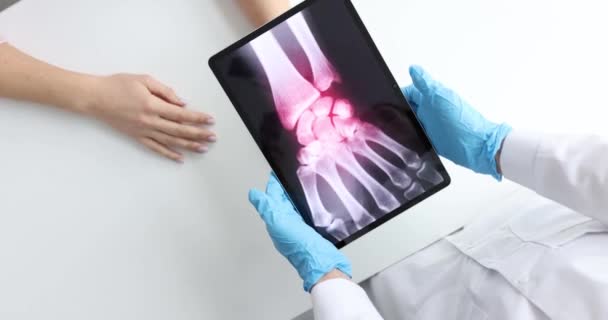 Inflamação dos ossos da mão no raio-x do filme 4k de câmera lenta do paciente — Vídeo de Stock