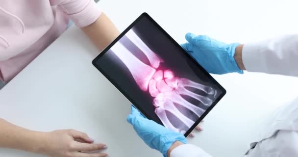 Inflammation des os des mains sur une radiographie du patient — Video