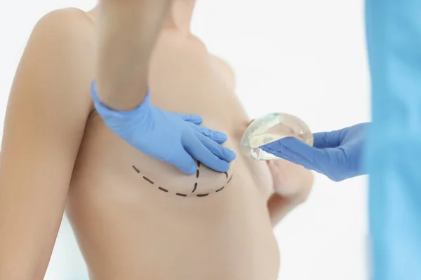 Doktor držet silikonový prsní implantát a palping klientské prsa — Stock fotografie