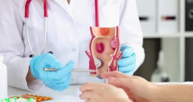 Doktor proktolog, rektum kapanış filminin yapay modelinde hasta hastalığı gösteriyor.