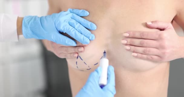 Nude body of sexy woman with blue surgical markings on chest — Vídeo de Stock