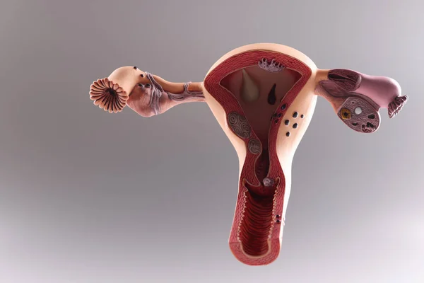 Anatomiczny model macicy i jajników, narządów rozrodczych kobiet — Zdjęcie stockowe