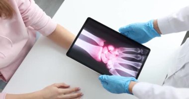 Doctor traumatologist holding digital tablet with xray near patient hand closeup 4k movie slow motion