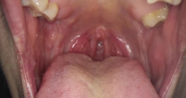 Human open mouth with glands and teeth closeup — Stock video