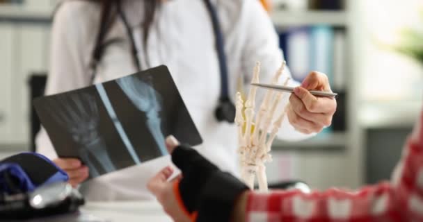 Doutor e paciente estão examinando um raio-X com lesão na mão — Vídeo de Stock