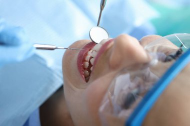 Diş hekimi klinikteki kadın hastaların ağız boşluğunu yakın çekim araçlarıyla inceliyor.
