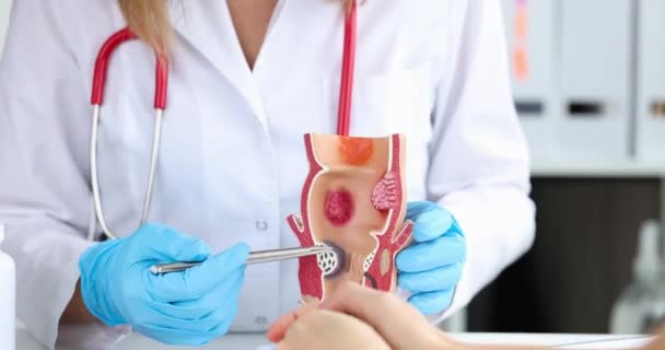 Läkaren visar bildandet av hemorrojder på modell av rektum närbild — Stockvideo