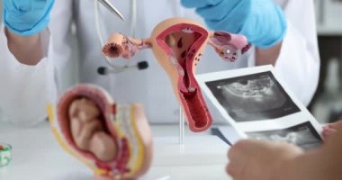 Doktor rahmin yapay modelindeki hastaya yumurtalıklardaki değişiklikleri açıklıyor ve ultrason görüntüsü 4K film gösteriyor.