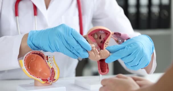 Γιατρός εξηγεί στην ασθενή διαδικασία γονιμοποίησης σε τεχνητά μοντέλα της μήτρας και του εμβρύου closeup 4k ταινία αργή κίνηση — Αρχείο Βίντεο