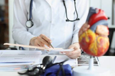 Doktor kardiyogramı yapay kalp modelinin arka planıyla karşılaştırıyor.