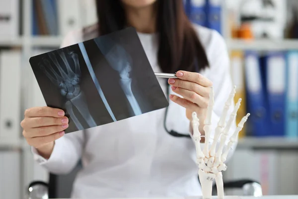 Traumatoloog onderzoekt röntgenfoto met arm letsel close-up — Stockfoto