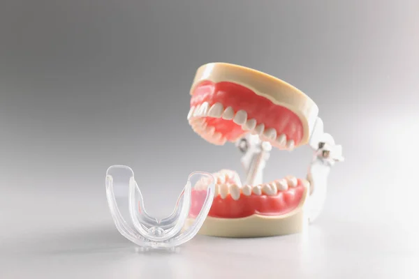 Μοντέλο δοντιών ανθρώπου, ορθοδοντικό οδοντικό μοντέλο δοντιών ή ανθρώπινη σιαγόνα, επιστόμιο — Φωτογραφία Αρχείου