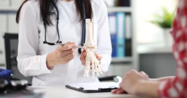 Doctor shows skeleton of leg and problem of bones in patient closeup — Stock Video