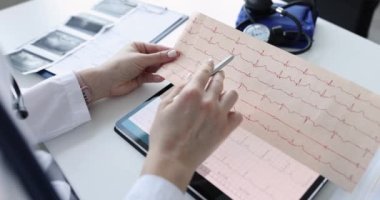 Doktor elleri hastanın kardiyogramının sonucunu tutuyor.