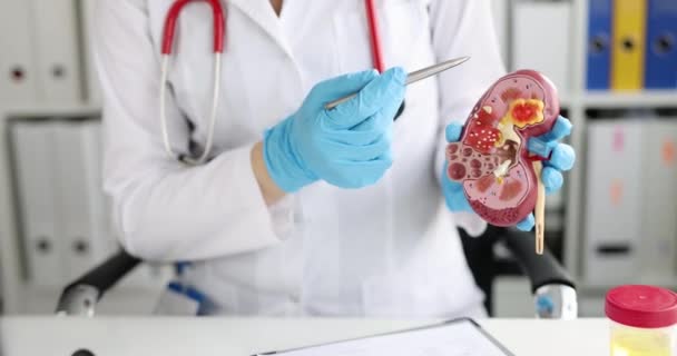 Doctor tonen met pen structuur van de menselijke nier op kunstmatig model closeup 4k film — Stockvideo
