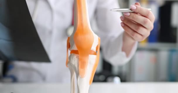Doctor con rayos X en las manos mostrando la estructura de la articulación de la rodilla en el modelo artificial de primer plano 4k película — Vídeos de Stock