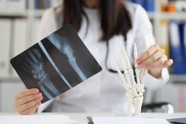 Radiographie de la main dans les mains d'un médecin, floue — Photo