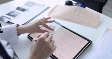 Doktor kardiyolog dijital tablette EKG üzerine çalışıyor. Yakın çekim 4K film.