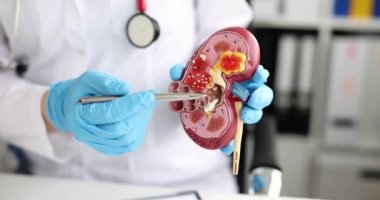 Doktor, insan böbreğinin yapay modelindeki hastalıklar üzerine kalemle 4K yakın çekim filmini gösteriyor.