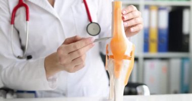 Fizyoterapist, insan dizi eklemlerinin anatomik modelini elinde tutuyor.