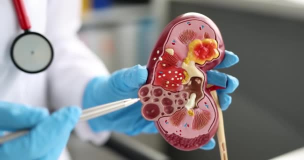 Nefrólogo o urólogo muestra maqueta de riñón humano — Vídeo de stock