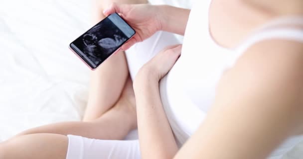 Femme enceinte regarde l'échographie du fœtus sur smartphone — Video