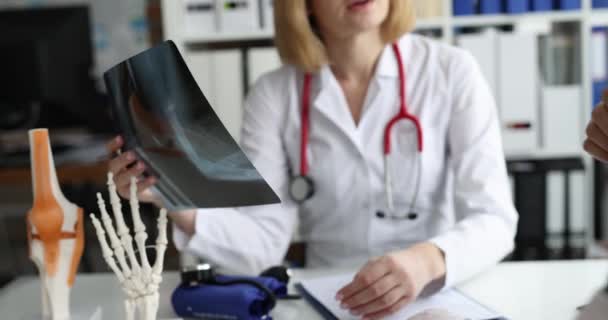 El médico examina la radiografía del paciente con el brazo roto — Vídeo de stock