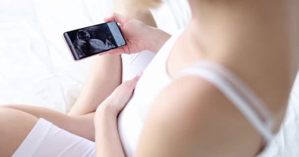 Pregnant woman looks into smartphone at ultrasound of child — Stock Video