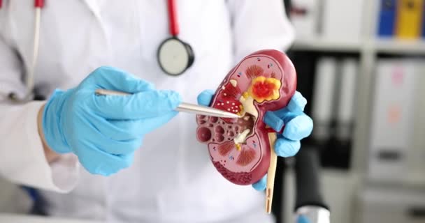 Arts of verpleegkundige toont model van nier closeup — Stockvideo