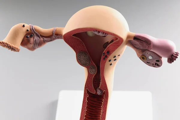 Anatomical model of womans uterus and ovaries, human reproductive organs — стоковое фото