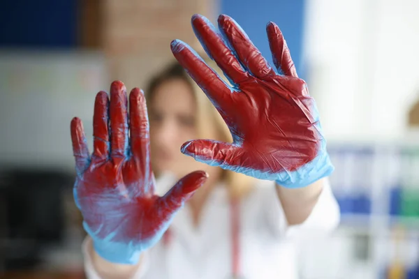 Blodig hand i läkare medicinska handskar på kliniken — Stockfoto