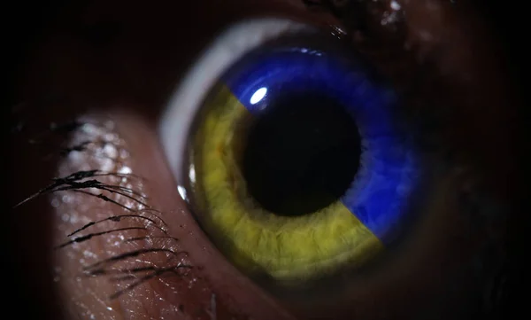 Female eye in blue and yellow iris color of Ukraine flag closeup — стоковое фото