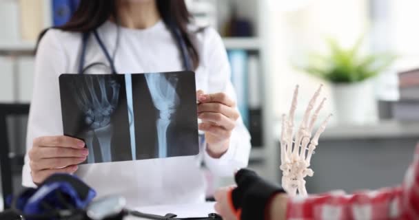 Traumatólogo examina radiografía de la mano del paciente — Vídeo de stock