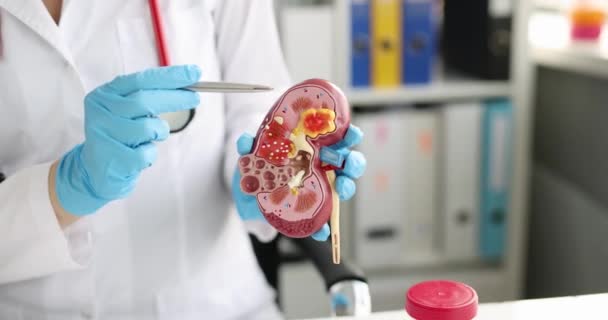 Educational model of human body of kidney in hands of doctor — Stock Video