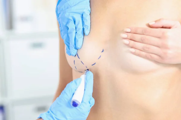 Doctor making marking on boob for future cosmetic surgery operation — Stock fotografie