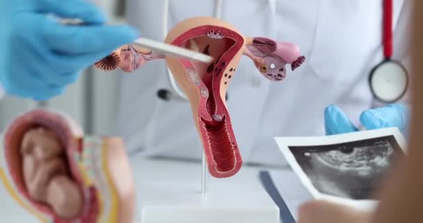 Gynekolog visar anatomi i livmodern och ultraljud av äggstockarna till patienten — Stockvideo