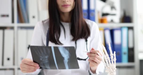 Женщина-врач изучает рентгеновские снимки рук — стоковое видео