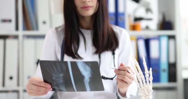 Female doctor examines x-ray photograph of hands — Stock Video