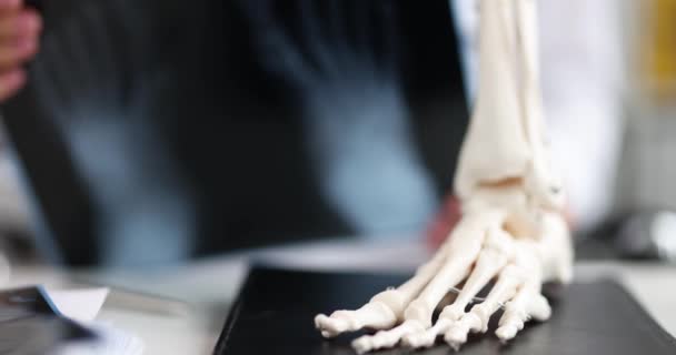 Surgeon examines x-ray of anatomy of foot — стоковое видео