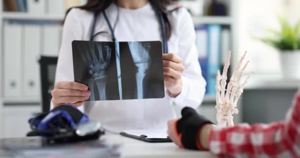 Traumatologist holds x-ray with fractured arm of patient — Vídeos de Stock