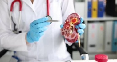 Doctor urologist and nephrologist holds kidney model