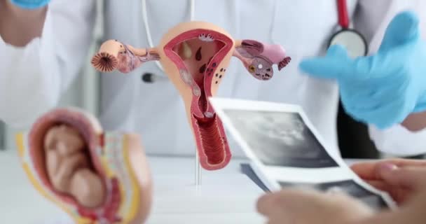 婦人科医と患者は子供の子宮と胎児の超音波を検査します — ストック動画